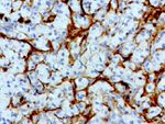 L1CAM Antibody in Immunohistochemistry (Paraffin) (IHC (P))