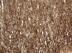L1CAM Antibody in Immunohistochemistry (Paraffin) (IHC (P))