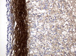 L1CAM Antibody in Immunohistochemistry (Paraffin) (IHC (P))