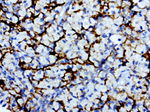 L1CAM Antibody in Immunohistochemistry (Paraffin) (IHC (P))