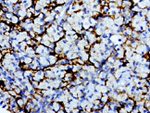 L1CAM Antibody in Immunohistochemistry (Paraffin) (IHC (P))