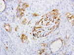 L1CAM Antibody in Immunohistochemistry (Paraffin) (IHC (P))