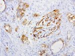 L1CAM Antibody in Immunohistochemistry (Paraffin) (IHC (P))