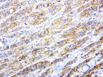 L1CAM Antibody in Immunohistochemistry (Paraffin) (IHC (P))