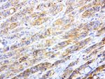 L1CAM Antibody in Immunohistochemistry (Paraffin) (IHC (P))