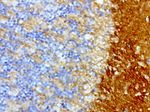 L1CAM Antibody in Immunohistochemistry (Paraffin) (IHC (P))