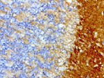 L1CAM Antibody in Immunohistochemistry (Paraffin) (IHC (P))