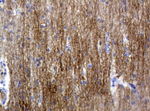 L1CAM Antibody in Immunohistochemistry (Paraffin) (IHC (P))