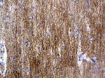 L1CAM Antibody in Immunohistochemistry (Paraffin) (IHC (P))