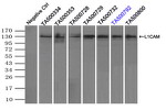 L1CAM Antibody in Immunoprecipitation (IP)