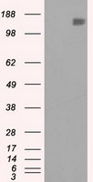 L1CAM Antibody in Western Blot (WB)