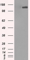L1CAM Antibody in Western Blot (WB)