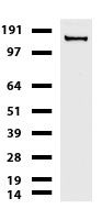 L1CAM Antibody in Western Blot (WB)