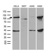 L3MBTL3 Antibody in Western Blot (WB)