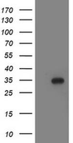 LACTB2 Antibody in Western Blot (WB)