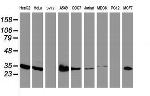 LACTB2 Antibody in Western Blot (WB)