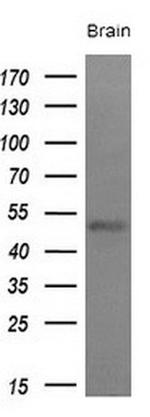 LAG3 Antibody in Western Blot (WB)