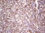 LAMA4 Antibody in Immunohistochemistry (Paraffin) (IHC (P))