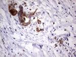 LAMB3 Antibody in Immunohistochemistry (Paraffin) (IHC (P))