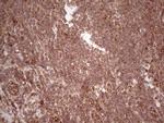LAMB3 Antibody in Immunohistochemistry (Paraffin) (IHC (P))