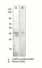 LAMP2 Antibody in Western Blot (WB)