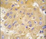 LAP3 Antibody in Immunohistochemistry (IHC)