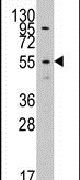 LAP3 Antibody in Western Blot (WB)