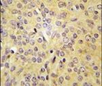 LARS Antibody in Immunohistochemistry (IHC)