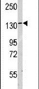 LARS Antibody in Western Blot (WB)