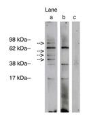 Lass1 Polyclonal Antibody