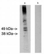 Lass2 Polyclonal Antibody