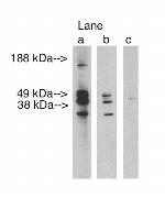 Lass3 Polyclonal Antibody