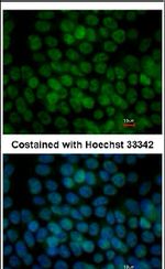 TFCP2L1 Antibody in Immunocytochemistry (ICC/IF)