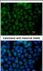 TFCP2L1 Antibody in Immunocytochemistry (ICC/IF)