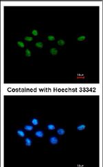 TFCP2L1 Antibody in Immunocytochemistry (ICC/IF)