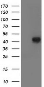 LCMT1 Antibody in Western Blot (WB)