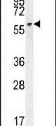LCOR Antibody in Western Blot (WB)