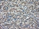 LDHA Antibody in Immunohistochemistry (Paraffin) (IHC (P))
