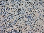 LDHA Antibody in Immunohistochemistry (Paraffin) (IHC (P))