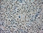 LDHA Antibody in Immunohistochemistry (Paraffin) (IHC (P))