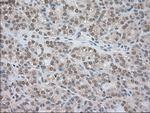 LDHA Antibody in Immunohistochemistry (Paraffin) (IHC (P))