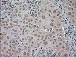 LDHA Antibody in Immunohistochemistry (Paraffin) (IHC (P))