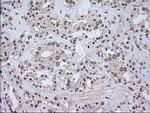 LDHA Antibody in Immunohistochemistry (Paraffin) (IHC (P))