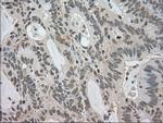 LDHA Antibody in Immunohistochemistry (Paraffin) (IHC (P))