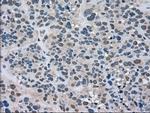 LDHA Antibody in Immunohistochemistry (Paraffin) (IHC (P))
