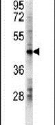 LDHD Antibody in Western Blot (WB)