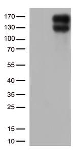 LDLR Antibody in Western Blot (WB)