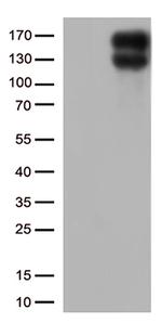 LDLR Antibody in Western Blot (WB)