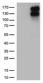 LDLR Antibody in Western Blot (WB)