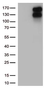 LDLR Antibody in Western Blot (WB)